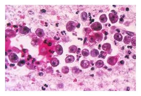  Naegleria fowleri: Een Microscopische Beestje dat een Grote Impact Kan Hebben!