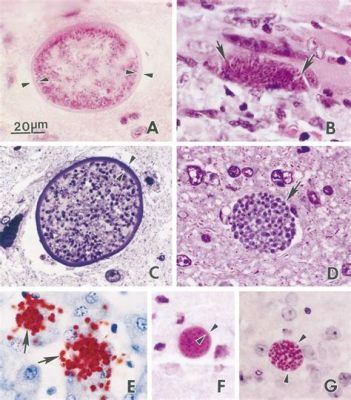  Neospora caninum: Een Microscopische Schurken die Zowel Huisdieren als Vee bedreigt!