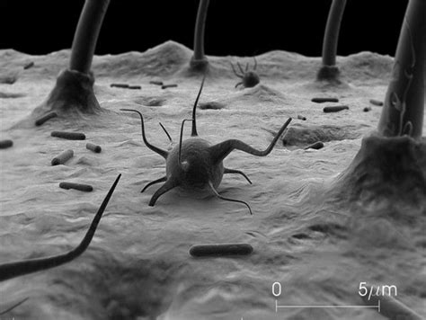   Xerodromella: Een microscopisch wonder met trilhaartjes die zoekt naar bacteriën in een wereld vol modder!