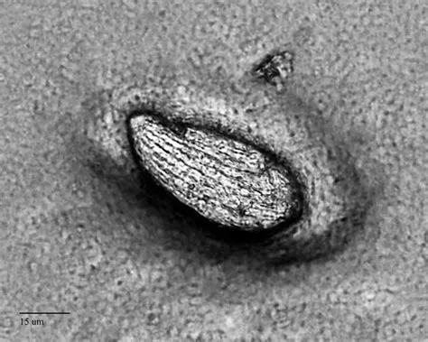  Jingle Bells! This Tiny Ciliate With Cilia Arranged In Spiral Rows Will Blow Your Mind!