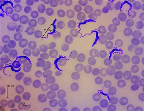  Trypanosoma: Een microscopische duivel die je bloedbaan kan terroriseren!